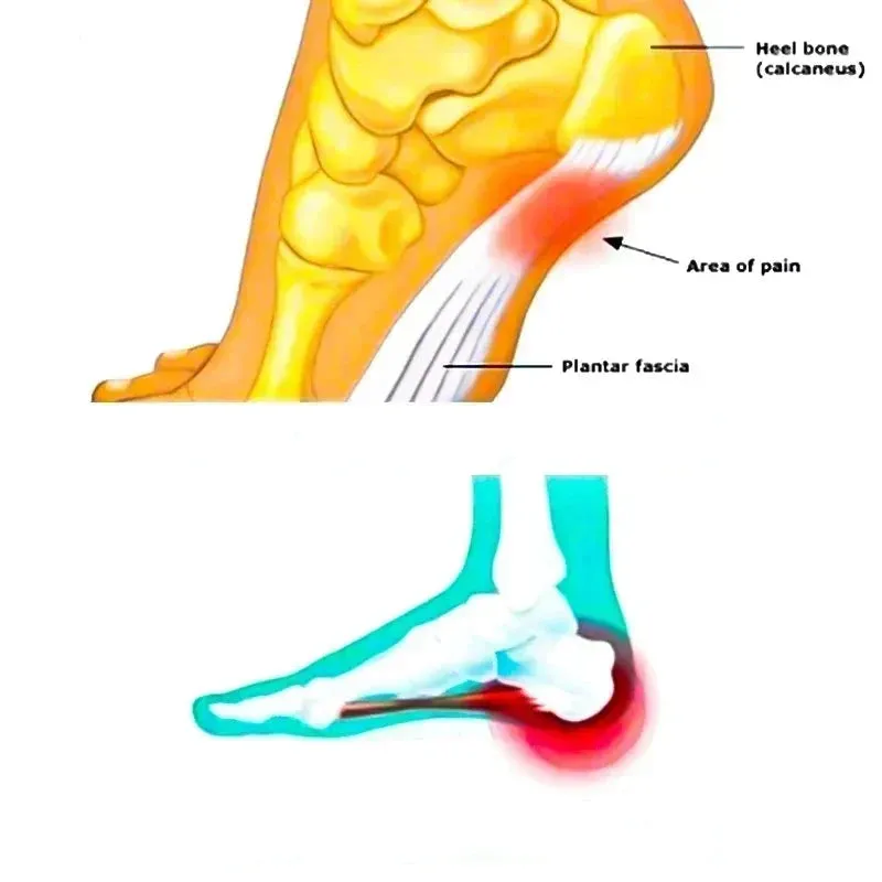 Anti-Fatigue Ankle Support Compression Socks